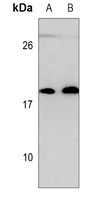 UBE2C Antibody