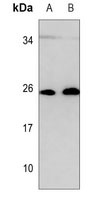 RAB27B Mouse Monoclonal Antibody