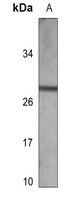 Kappa light chain Mouse Monoclonal Antibody
