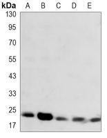 SOD2 Mouse Monoclonal Antibody