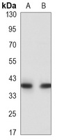 HLA-A Rabbit Monoclonal Antibody
