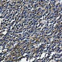HLA-A Rabbit Monoclonal Antibody