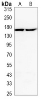 EGFR Mouse Monoclonal Antibody