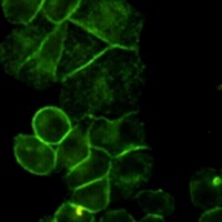 EGFR Mouse Monoclonal Antibody