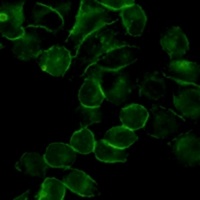 EGFR Mouse Monoclonal Antibody