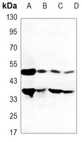 DR5 Antibody