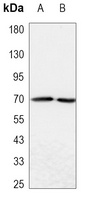 ALPP Mouse Monoclonal Antibody