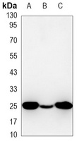 PGP9.5 Mouse Monoclonal Antibody
