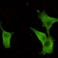 PGP9.5 Mouse Monoclonal Antibody