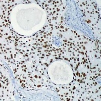 DNA-PKcs Mouse Monoclonal Antibody