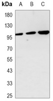 Hexokinase 2 Mouse Monoclonal Antibody