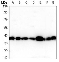 SIRT6 Mouse Monoclonal Antibody
