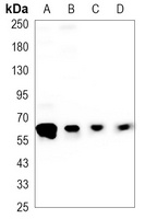 AKT Antibody