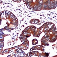 GRP78 Mouse Monoclonal Antibody