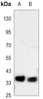 CD326 Mouse Monoclonal Antibody