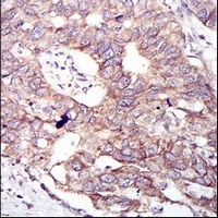 GSK3 beta Mouse Monoclonal Antibody