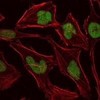 MCM2 Mouse Monoclonal Antibody