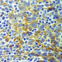 ALPP Mouse Monoclonal Antibody