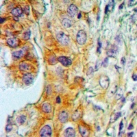 PAK2 Mouse Monoclonal Antibody