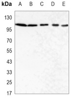 PYK2 Mouse Monoclonal Antibody
