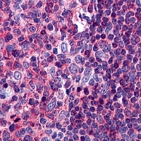 PYK2 Mouse Monoclonal Antibody