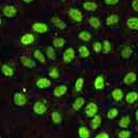MLH1 Mouse Monoclonal Antibody