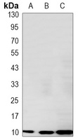 S100-A6 Mouse Monoclonal Antibody