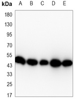 Alpha-enolase Mouse Monoclonal Antibody
