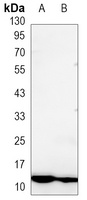 S100-A4 Mouse Monoclonal Antibody