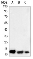 S100-A10 Mouse Monoclonal Antibody