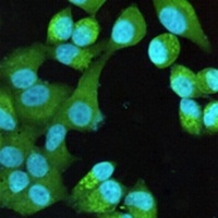 S100-A10 Mouse Monoclonal Antibody