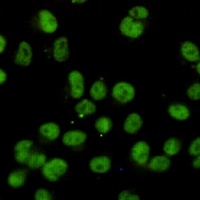 RBBP5 Mouse Monoclonal Antibody