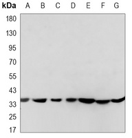 EIF2S1 Mouse Monoclonal Antibody