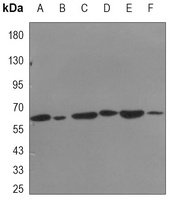 HSP60 Antibody