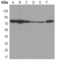 DDX3X Mouse Monoclonal Antibody