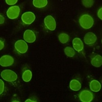 BRG1 Mouse Monoclonal Antibody