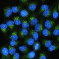 MMP2 Mouse Monoclonal Antibody