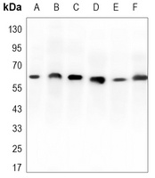 RPA1 Mouse Monoclonal Antibody