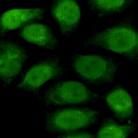 RPA1 Mouse Monoclonal Antibody
