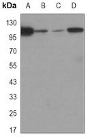 Focal Adhesion Kinase Mouse Monoclonal Antibody