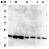 CDX2 Mouse Monoclonal Antibody
