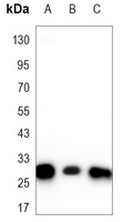 CBR1 Mouse Monoclonal Antibody