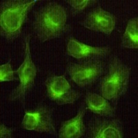 CBR1 Mouse Monoclonal Antibody