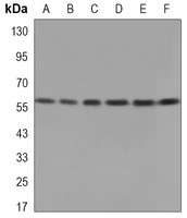 PDC-E2 Mouse Monoclonal Antibody