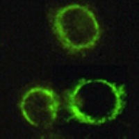 PDC-E2 Mouse Monoclonal Antibody