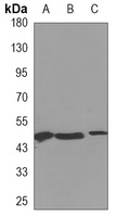 CALU Mouse Monoclonal Antibody