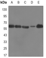 ATIC Mouse Monoclonal Antibody