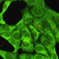 Pyruvate Kinase Antibody