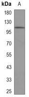 FYB Mouse Monoclonal Antibody