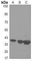PRMT1 Mouse Monoclonal Antibody